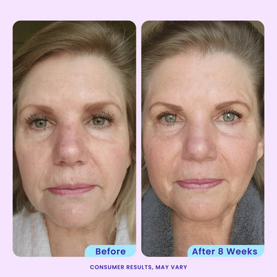 Anti Wrinkle Moisturizer
