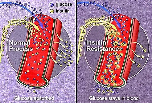 1: Your Cells Have Stopped Listening to Insulin