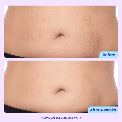 STARK™ Tighten & Smooth Firming Cream