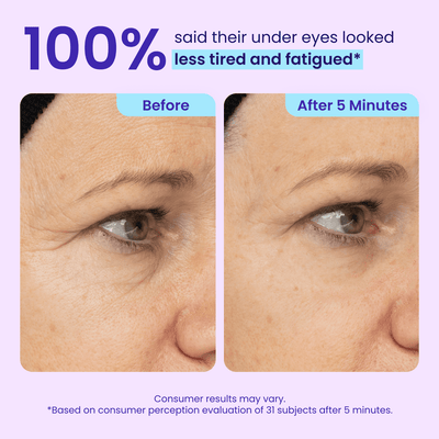 STARK™ Instant Lift Gel