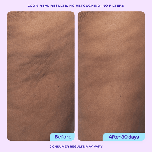 STARK™ Tighten & Smooth Firming Cream