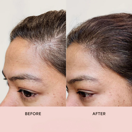 STARK™ Hair Growth Serum