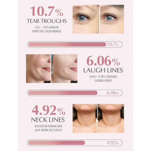 StarkLifestyle™ Anti-Aging Balm